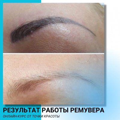 Онлайн-курс: Удаление перманентного макияжа и татуажа